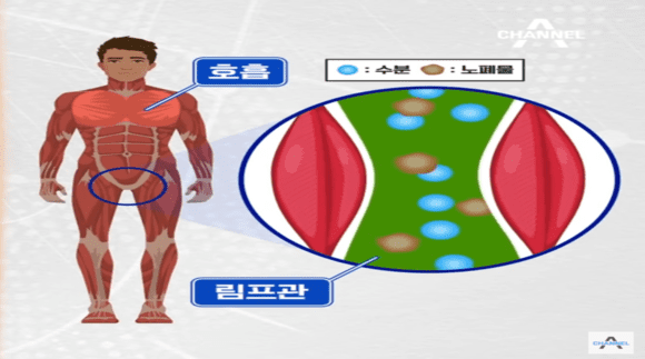서혜부위치