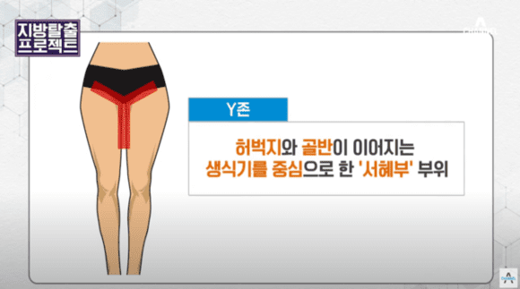 서혜부y존